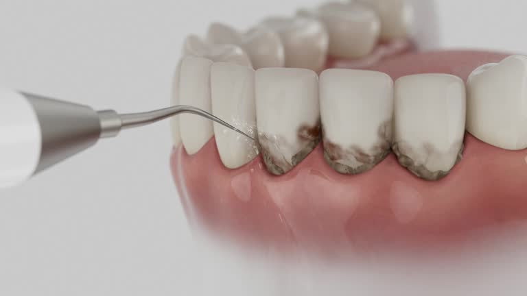 Reliable Emergency Dentist contractor in Salem, VA by Smile Center Dentistry